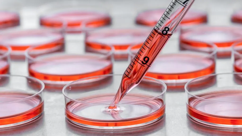Cell Culture Media and Supplements