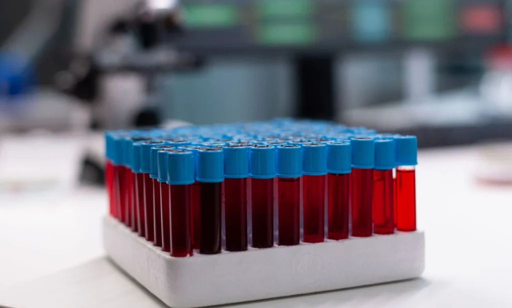 Density Gradient Media