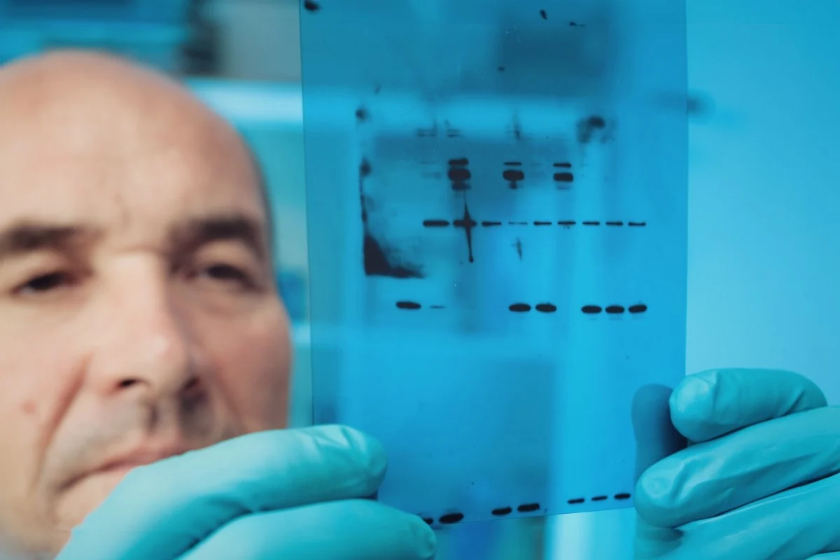 Western Blot Imagers